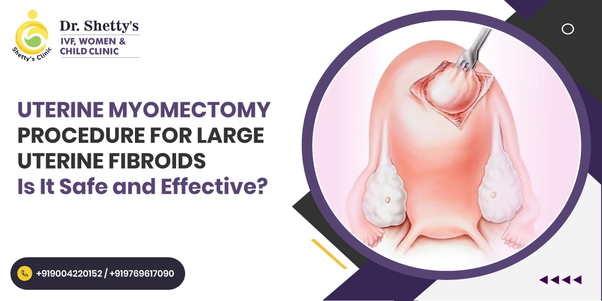 Uterine-Myomectomy-surgery