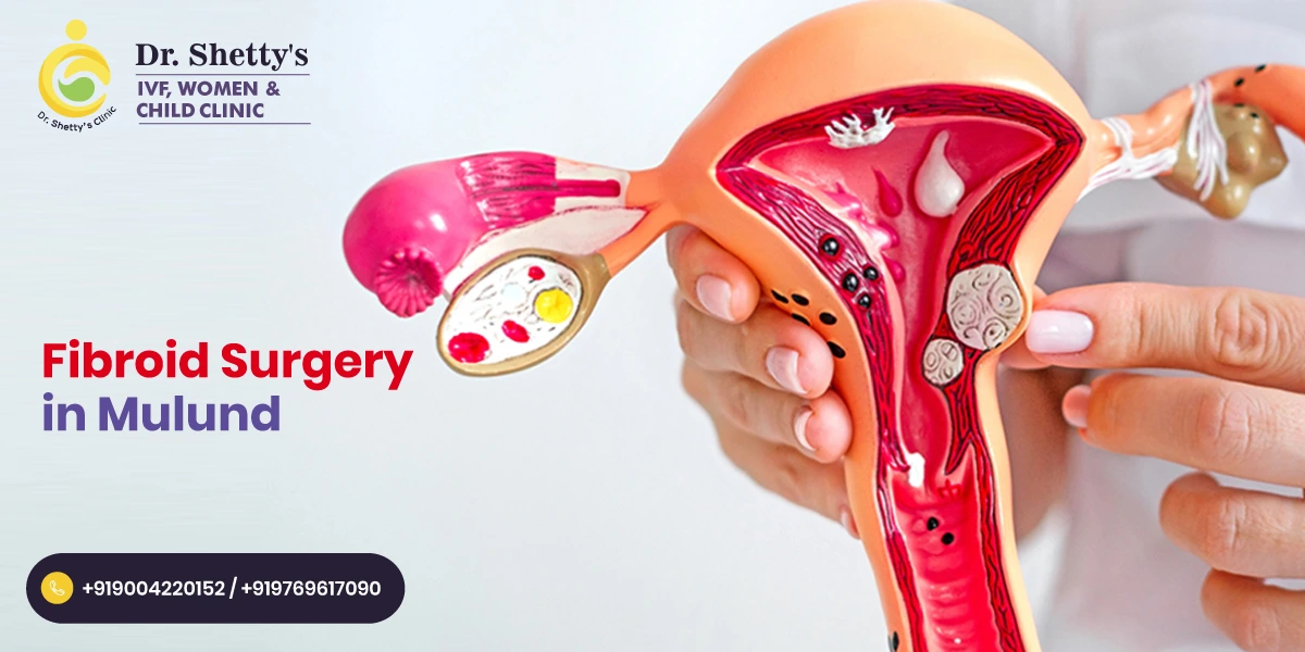 Fibroids in Young Women: When Surgery Is Needed and Treatment Options Available