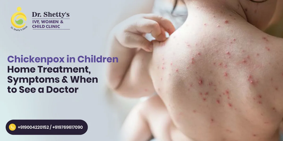 Chickenpox in Children: Home Treatment, Symptoms & When to See a Doctor