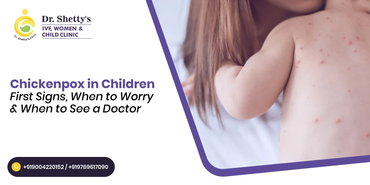 Chickenpox in Children: First Signs, When to Worry & When to See a Doctor