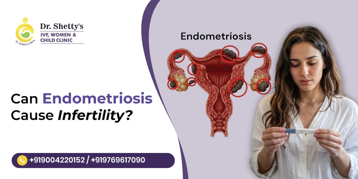 Can Endometriosis Cause Infertility